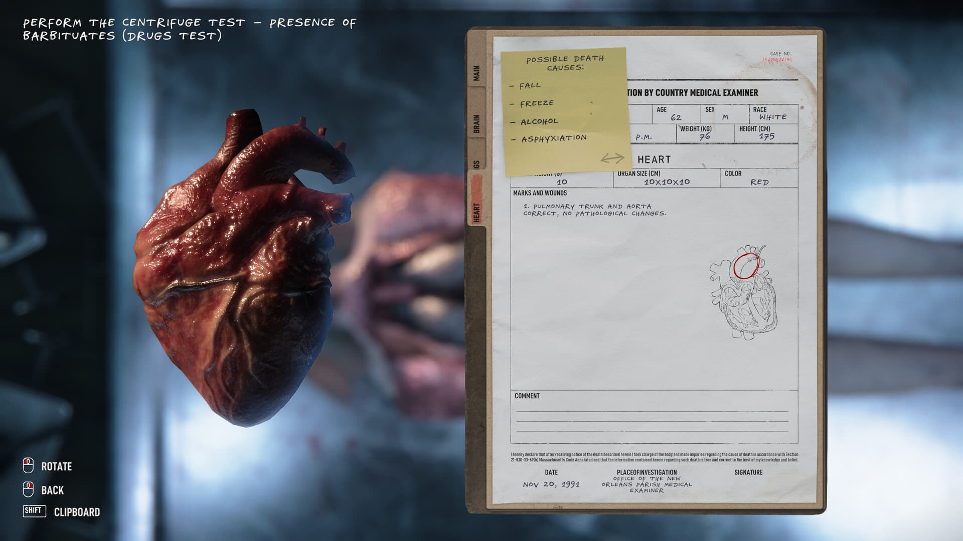Autopsy Simulator — Steam Game Key — 5